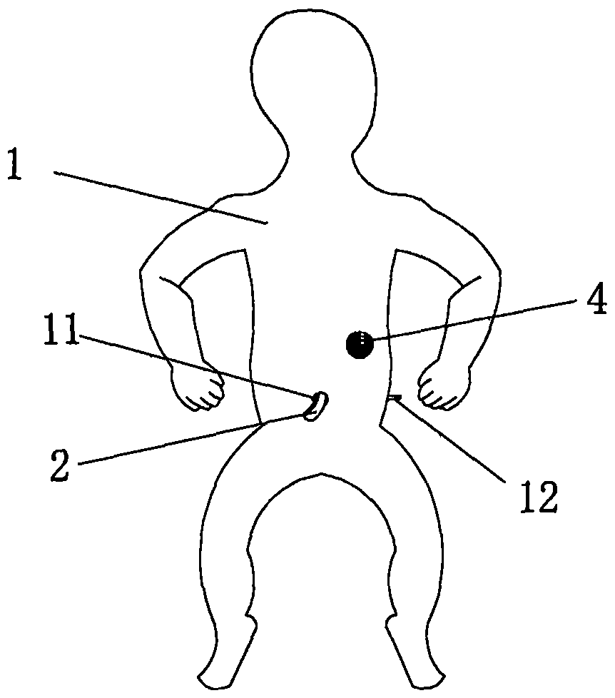 臍帶結(jié)扎實(shí)訓(xùn)裝置的制造方法附圖